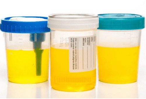 récipients d'urine en plastique